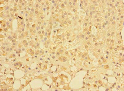 PLEKHS1 Antibody in Immunohistochemistry (Paraffin) (IHC (P))