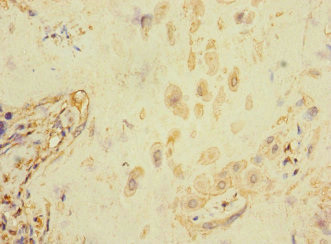 FCRL6 Antibody in Immunohistochemistry (Paraffin) (IHC (P))