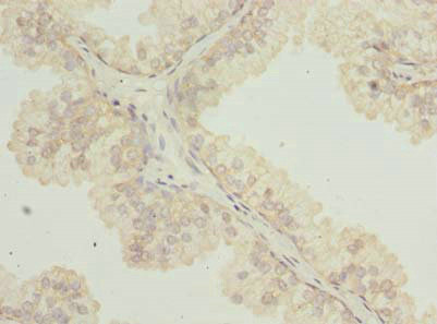 TTC38 Antibody in Immunohistochemistry (Paraffin) (IHC (P))