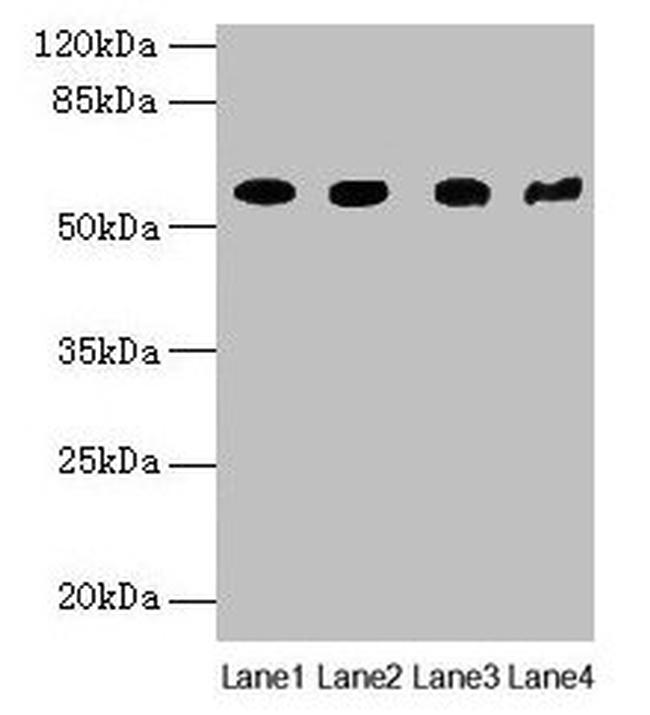 KRT79 Antibody in Western Blot (WB)