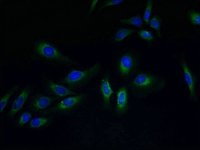 PVRIG Antibody in Immunocytochemistry (ICC/IF)