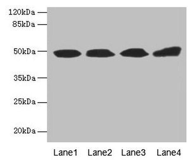 TBCEL Antibody in Western Blot (WB)