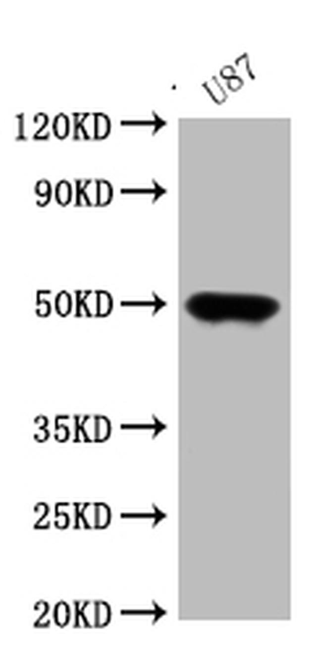 ATAT1 Antibody in Western Blot (WB)