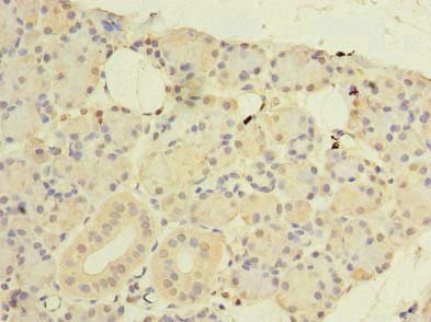 CWF19L1 Antibody in Immunohistochemistry (Paraffin) (IHC (P))