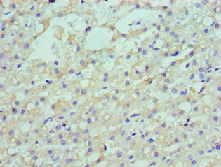 LDLRAP1 Antibody in Immunohistochemistry (Paraffin) (IHC (P))