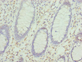 KHDRBS2 Antibody in Immunohistochemistry (Paraffin) (IHC (P))
