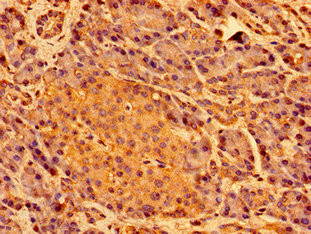 SHE Antibody in Immunohistochemistry (Paraffin) (IHC (P))