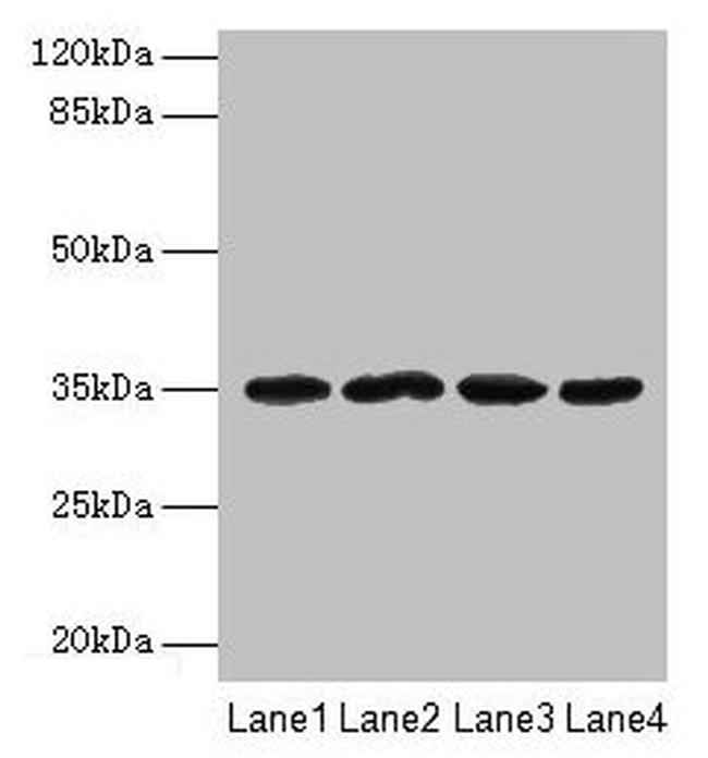 METRNL Antibody in Western Blot (WB)