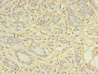 CCP2 Antibody in Immunohistochemistry (Paraffin) (IHC (P))