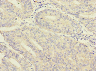 Morn5 Antibody in Immunohistochemistry (Paraffin) (IHC (P))