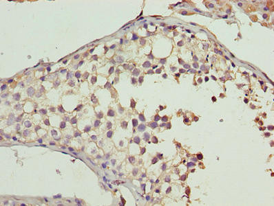 CYB5R2 Antibody in Immunohistochemistry (Paraffin) (IHC (P))