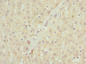 NHLRC1 Antibody in Immunohistochemistry (Paraffin) (IHC (P))