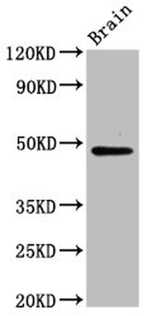 RAD9B Antibody in Western Blot (WB)