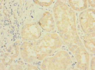 LRRC31 Antibody in Immunohistochemistry (Paraffin) (IHC (P))