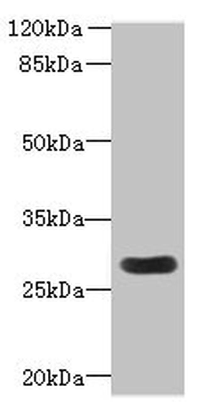 MORN3 Antibody in Western Blot (WB)