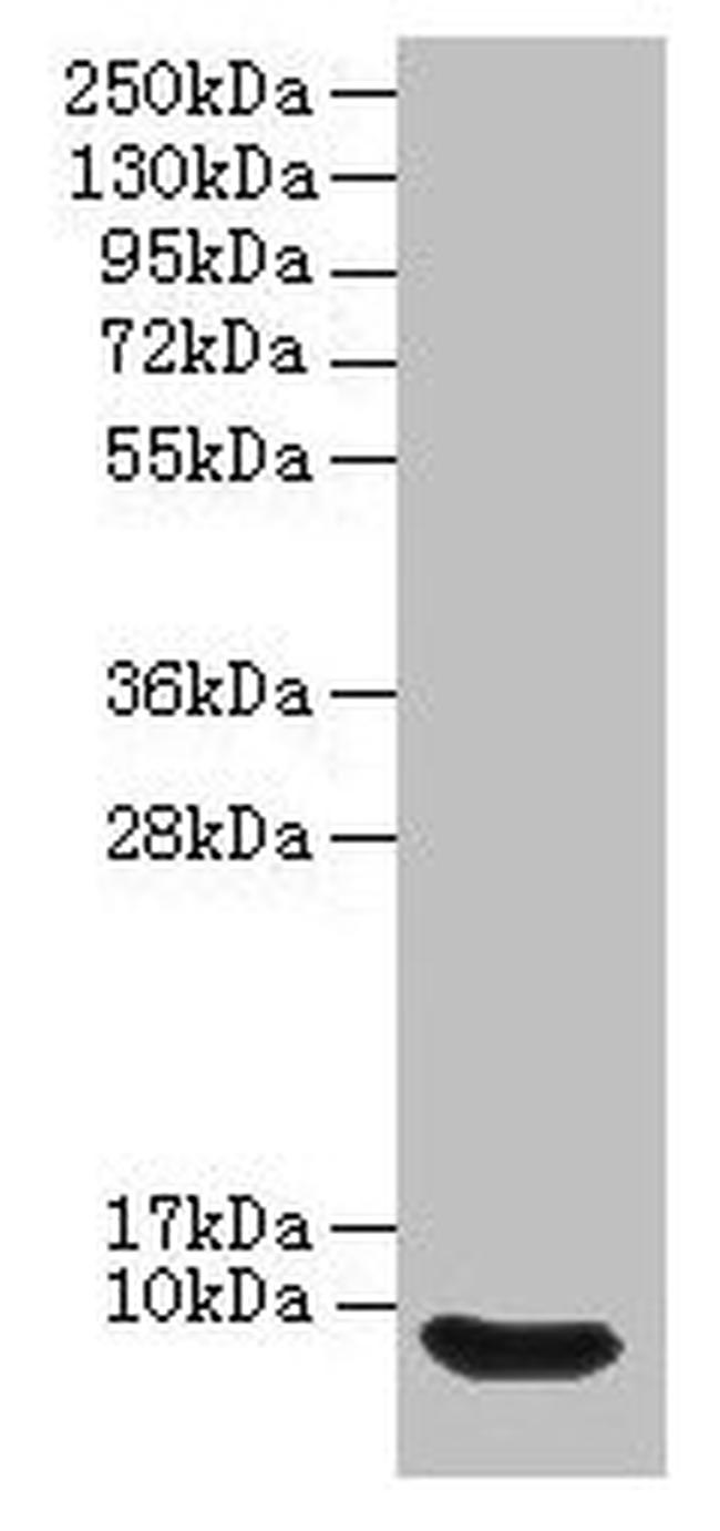 DEFB114 Antibody in Western Blot (WB)