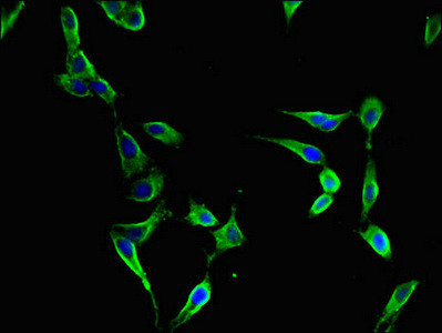 FBXL22 Antibody in Immunocytochemistry (ICC/IF)