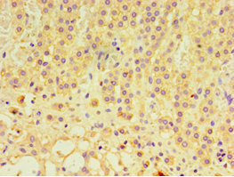 GTF2H2C Antibody in Immunohistochemistry (Paraffin) (IHC (P))