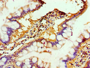 ALKBH2 Antibody in Immunohistochemistry (Paraffin) (IHC (P))