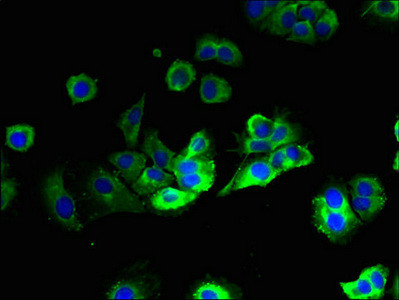 PTPLB Antibody in Immunocytochemistry (ICC/IF)