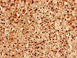 FGD6 Antibody in Immunohistochemistry (Paraffin) (IHC (P))