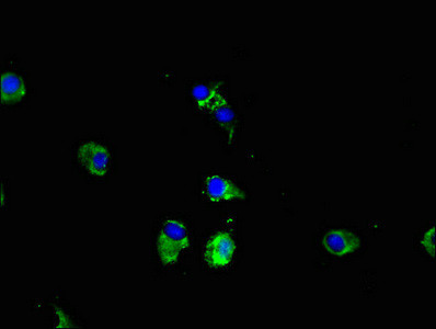 CPEB2 Antibody in Immunocytochemistry (ICC/IF)