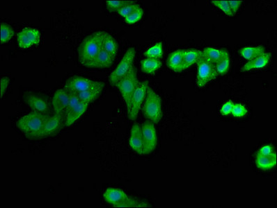NIT1 Antibody in Immunocytochemistry (ICC/IF)