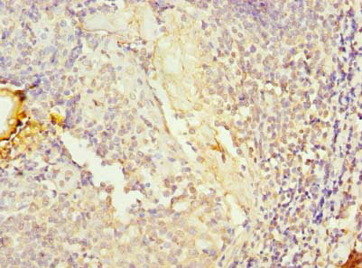 KIAA0907 Antibody in Immunohistochemistry (Paraffin) (IHC (P))