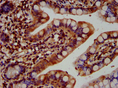 KTN1 Antibody in Immunohistochemistry (Paraffin) (IHC (P))