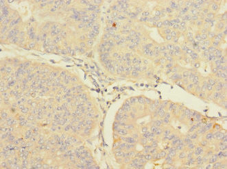 CIR1 Antibody in Immunohistochemistry (Paraffin) (IHC (P))