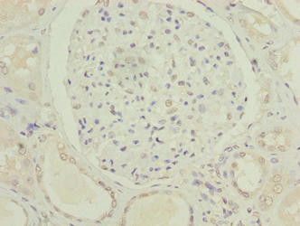 C5orf24 Antibody in Immunohistochemistry (Paraffin) (IHC (P))