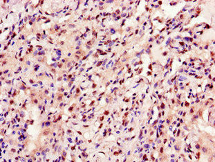 ANKRD23 Antibody in Immunohistochemistry (Paraffin) (IHC (P))