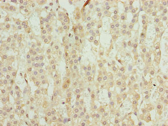 TRAPPC6B Antibody in Immunohistochemistry (Paraffin) (IHC (P))