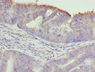 TTC30A Antibody in Immunohistochemistry (Paraffin) (IHC (P))