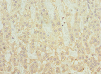 SNX32 Antibody in Immunohistochemistry (Paraffin) (IHC (P))