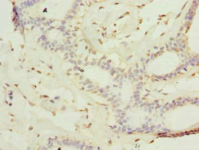 KATNAL2 Antibody in Immunohistochemistry (Paraffin) (IHC (P))