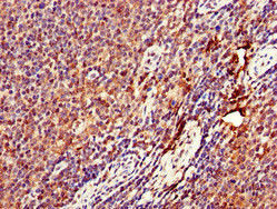 DENND1C Antibody in Immunohistochemistry (Paraffin) (IHC (P))