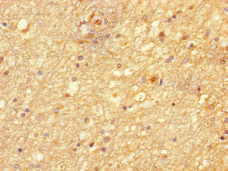 NIM1 Antibody in Immunohistochemistry (Paraffin) (IHC (P))