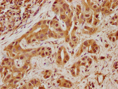 Tensin 4 Antibody in Immunohistochemistry (Paraffin) (IHC (P))