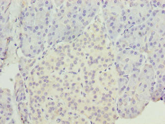 EGFL6 Antibody in Immunohistochemistry (Paraffin) (IHC (P))