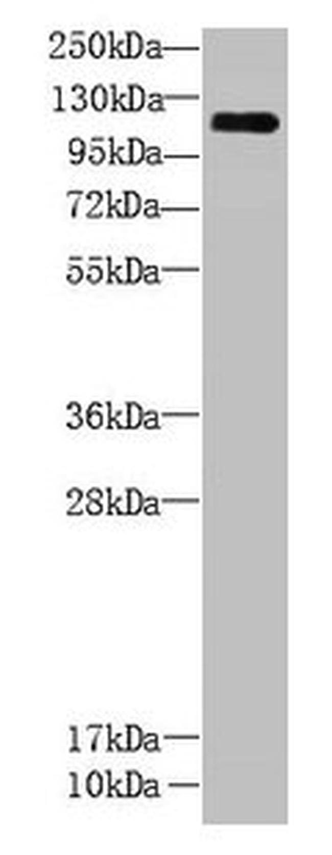 CCDC103 Antibody in Western Blot (WB)