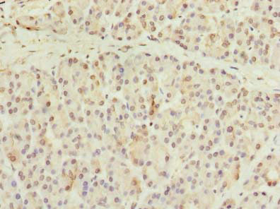 CCDC116 Antibody in Immunohistochemistry (Paraffin) (IHC (P))