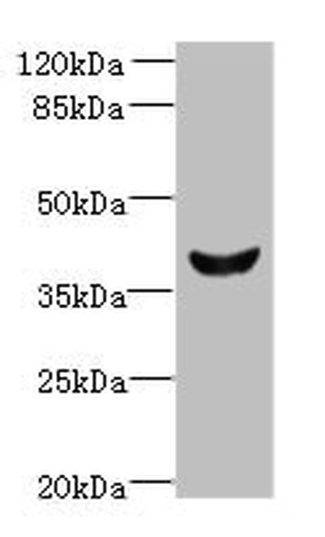 DLK2 Antibody in Western Blot (WB)