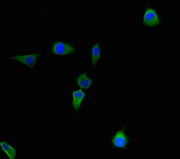 CBWD2 Antibody in Immunocytochemistry (ICC/IF)