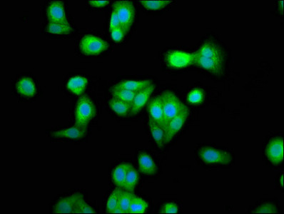 DRB1 Antibody in Immunocytochemistry (ICC/IF)