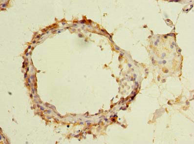 FAM126B Antibody in Immunohistochemistry (Paraffin) (IHC (P))