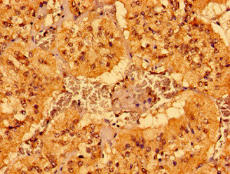 MCAT Antibody in Immunohistochemistry (Paraffin) (IHC (P))