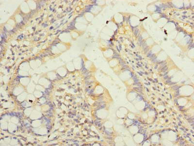 KLHDC8A Antibody in Immunohistochemistry (Paraffin) (IHC (P))