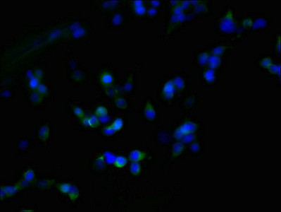 ZDHHC23 Antibody in Immunocytochemistry (ICC/IF)