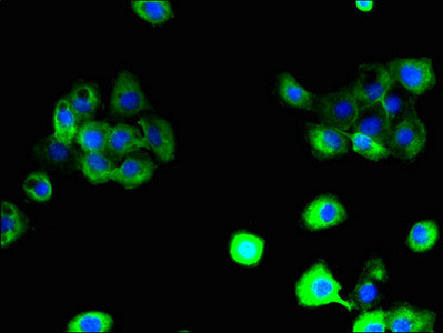 SLC38A6 Antibody in Immunocytochemistry (ICC/IF)